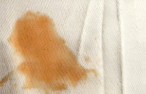 How to get yellow stains out of white sheets » Remove Any Stains