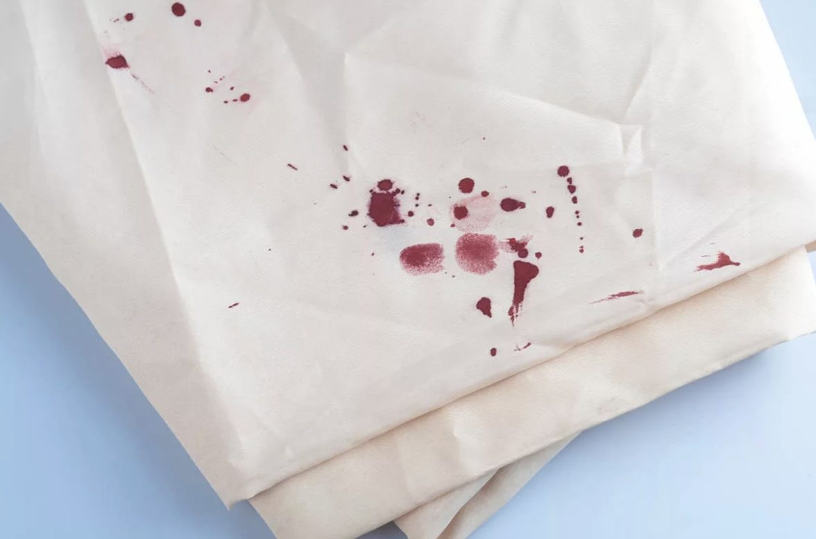 How to get blood out of sheets » Remove Any Stains