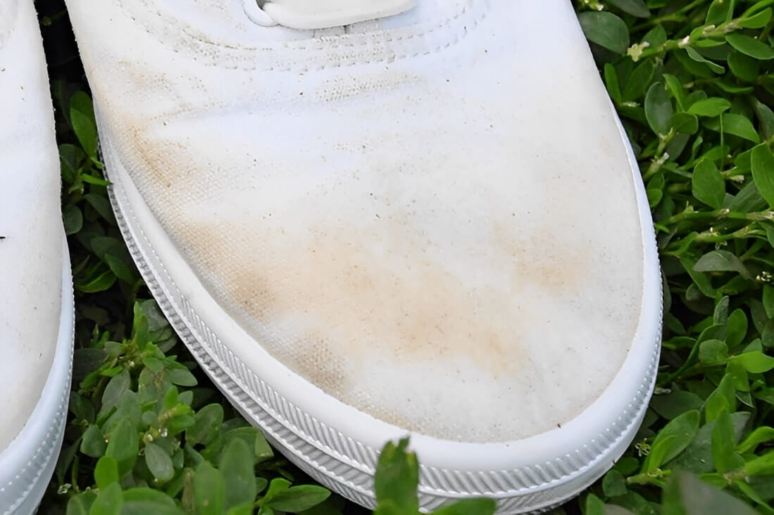 How to remove yellow stains from white shoes » Remove Any Stains